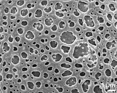 exine surface