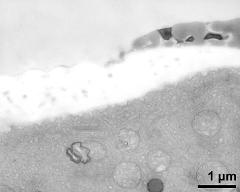 pollen wall at transition of aperture and interapertural area