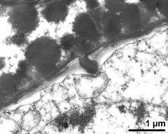 pollen wall, endexine infolded