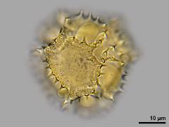 hydrated pollen,equatorial view