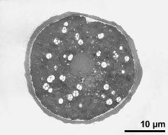 pollen grain in cross section