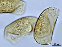 acetolyzed pollen