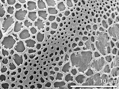 exine surface (equator)