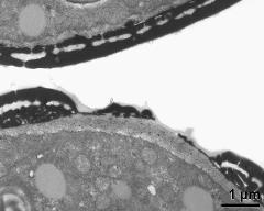 pollen wall, aperture area and interapertural area