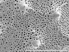 exine surface