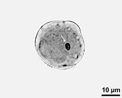 pollen grain with generative cell (arrow)