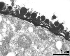 pollen wall of microspore, endexine lamellar