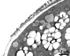 pollen wall, transition of aperture to interapertural area