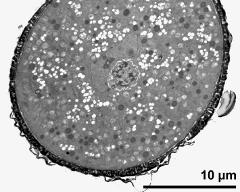 detail of pollen grain with generative cell