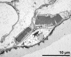 anther cells, nuclei with calcium oxalate crystals