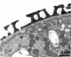 interapertural area of pollen wall