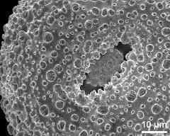 aperture of dry pollen grain
