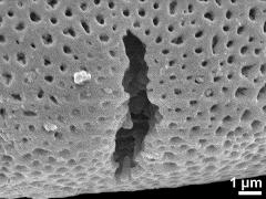 acetolyzed pollen,aperture