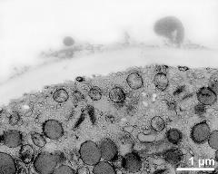 apertural area of pollen wall