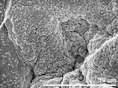 Ubisch bodies on inner locular wall