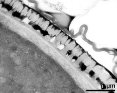 pollen wall in interapertural area with pollenkitt