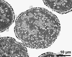 cross section of pollen grains