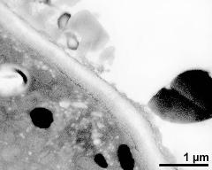 pollen wall at transition of aperture and interapertural area