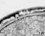 interapertural area of pollen wall, intine (I), endexine (E)