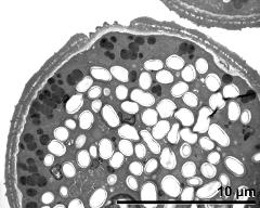 pollen wall in cross section, lipids (electron-dense), starch (electron-lucent)