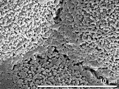 exine surface