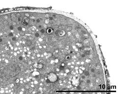 pollen wall, aperture area