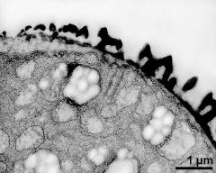 pollen wall at transition of aperture and interapertural area