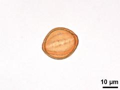equatorial view,acetolyzed pollen