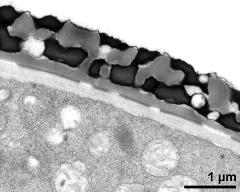 pollen wall, interapertural area