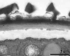 interapertural area of pollen wall