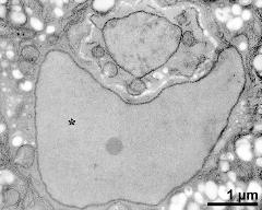 vegetative nucleus (asterisk) and generative cell