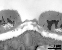 apertural area of pollen wall