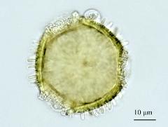 acetolyzed pollen,polar view