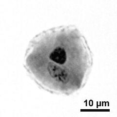 generative cell (dark) and vegetative nucleus