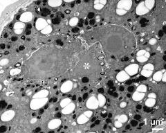 pollen grain at second pollen mitosis; vegetative nucleus (asterisk)