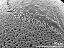 sulcus border