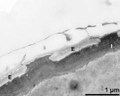 interapertural area of pollen wall, intine (I), endexine (E)