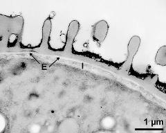 interapertural area of pollen wall, intine (I), endexine (E)