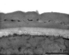 interapertural area of pollen wall