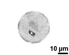 generative cell (asterisk) and vegetative nucleus