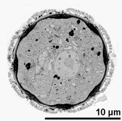 total view of pollen grain; note apertural intine thickenings