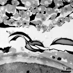 pollen wall and tapetum cells with Ubisch bodies (asterisks)