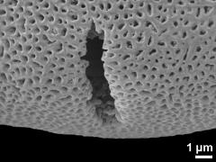 acetolyzed pollen,aperture detail