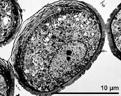 pollen grain in cross section