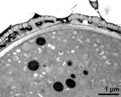 pollen wall, aperture in cross section