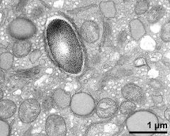 cytoplasm with organells