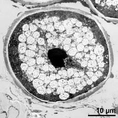 generative cell (right) and vegetative nucleus (left, dark); note starch grains (white)
