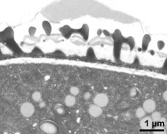 pollen wall, interapertural area, endexine clearly visible