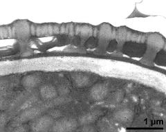 pollen wall, interapertural area, endexine clearly visible