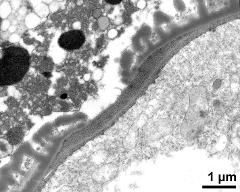 pollen wall, aperture area